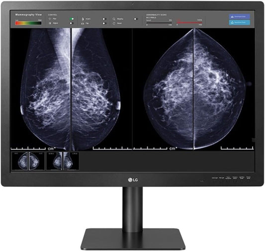 LG 31IN Medical Anti-Glare, 3H DIGNOSTIC Monitor 4200 X 2800